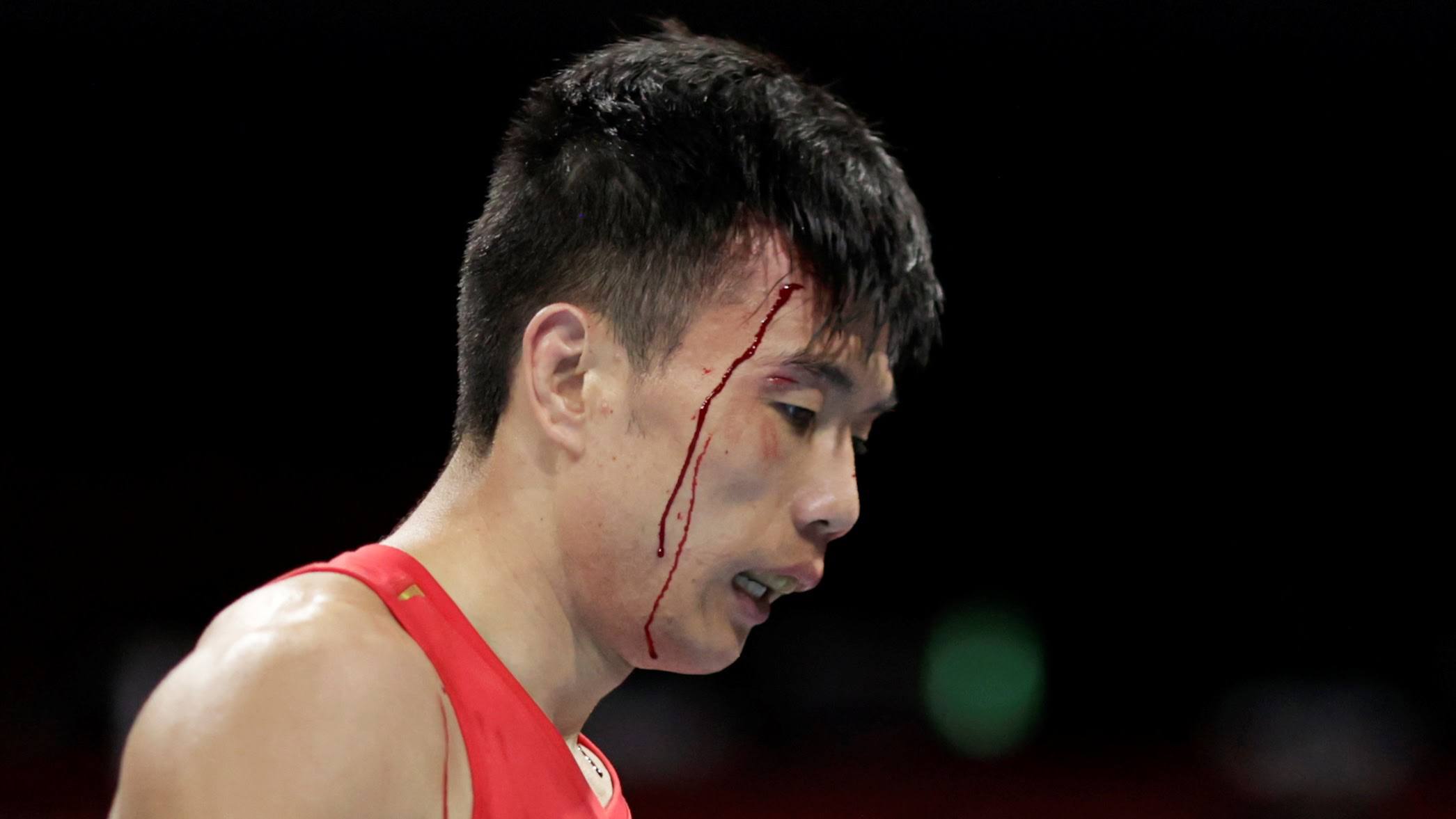 Hồ Kiến Quan chảy máu trong trận đấu với Ryomei Tanaka ở vòng 1/8 boxing hạng 52kg nam hôm Chủ nhật 1/8. Ảnh: Reuters