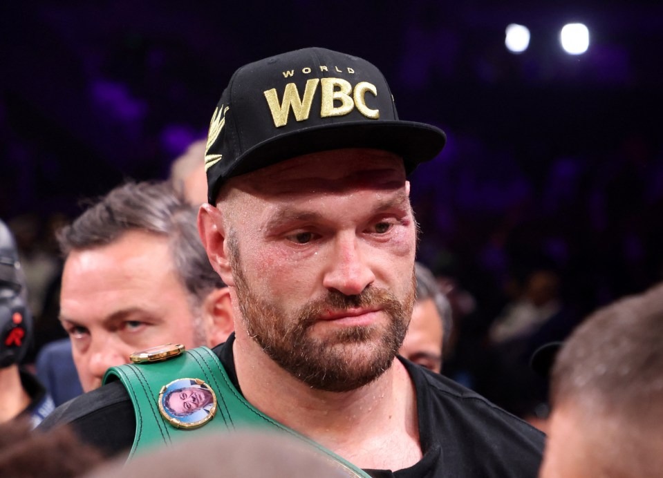 Fury bị vết bầm lớn ở mắt trái và trán sau trận thắng điểm Ngannou. Ảnh: Reuters